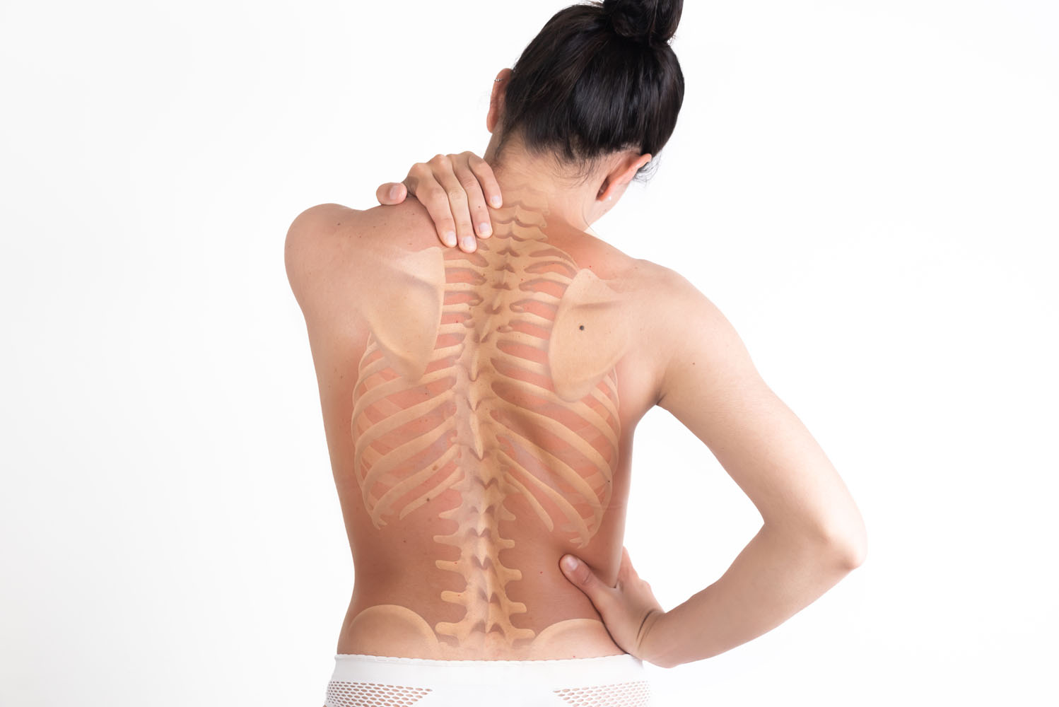 Scoliosis